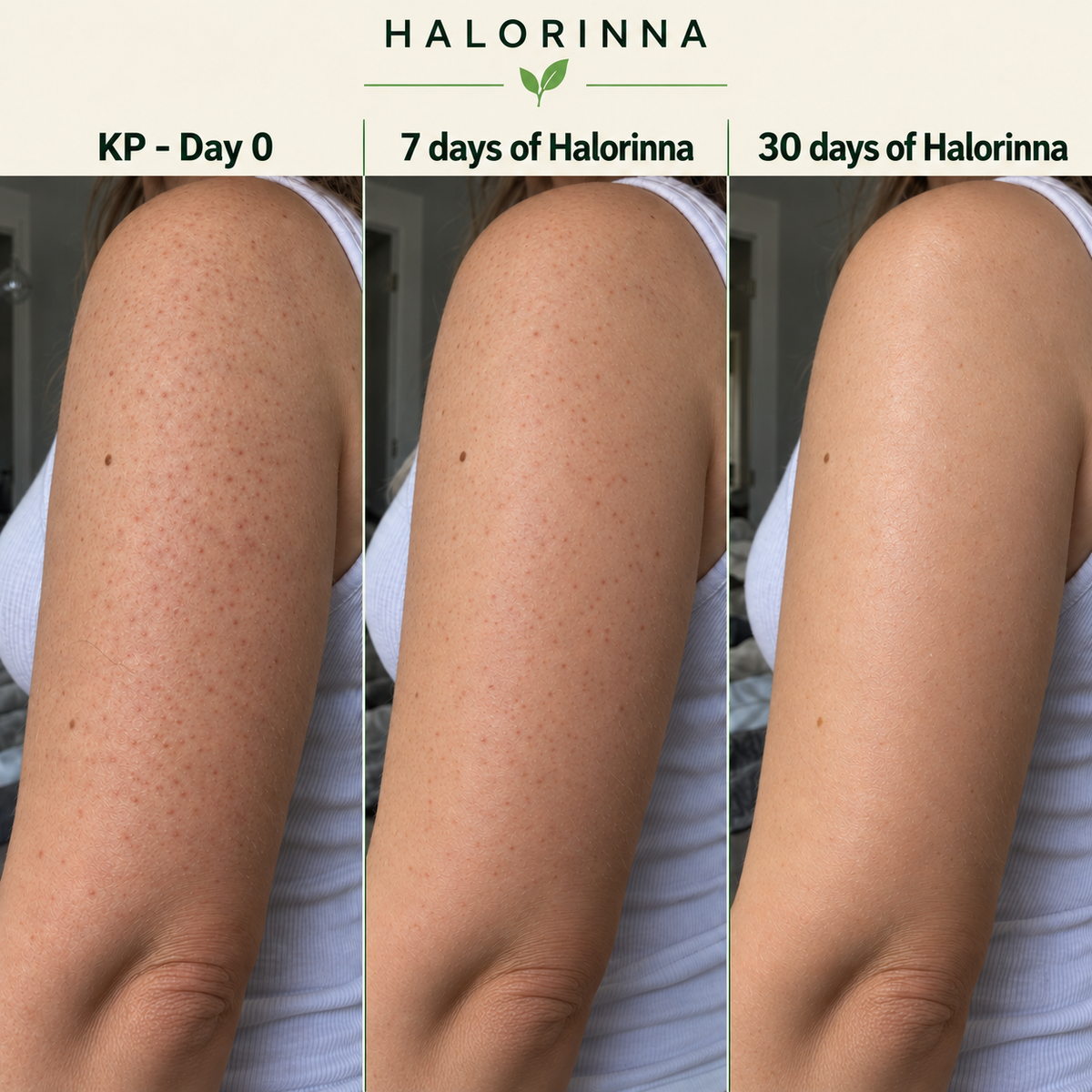 Halorinna skin appearance comparison at day 0, 7 days, and 30 days